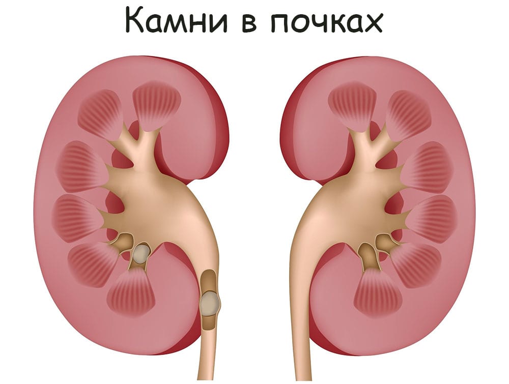 Кракен даркнет только через тор скачать